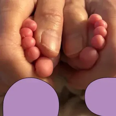 Babyzoneterapi