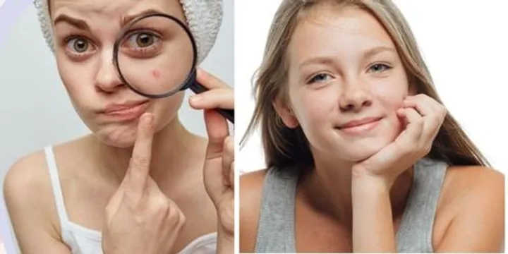 Puberty Clues