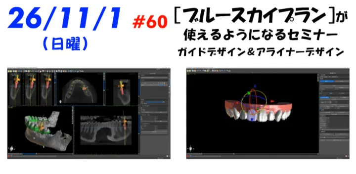 26/11/1　１時間で（歯科用）サージカルガイドが作れる―【ブルースカイプラン】セミナー