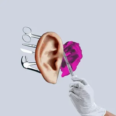 Surgery #1 @ KUBE